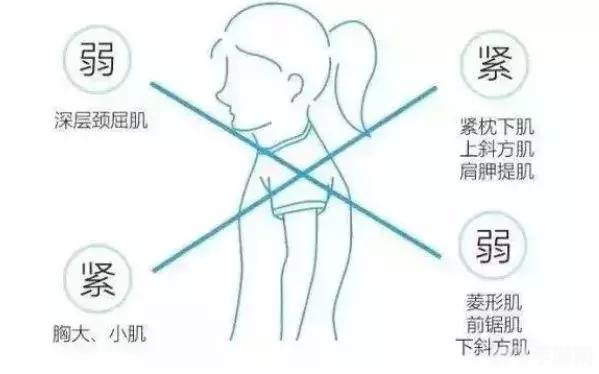 揭秘肩膀内扣梗背后的真相与改善方法